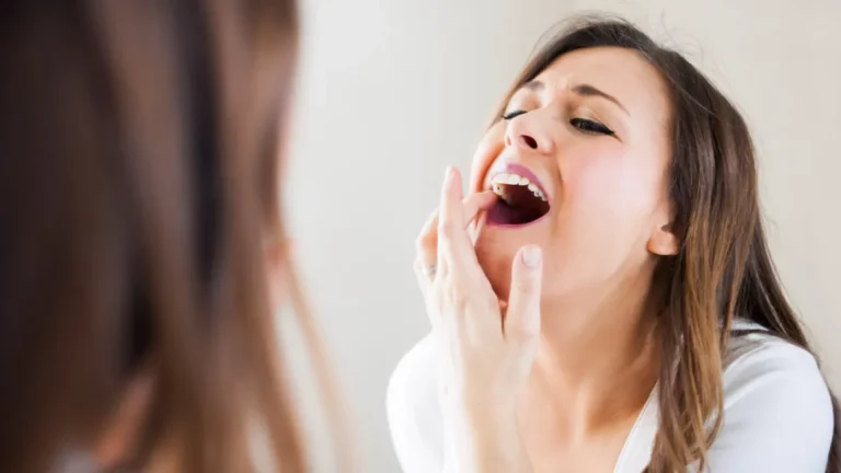 Dealing with Black Lines on Teeth: Effective Solutions