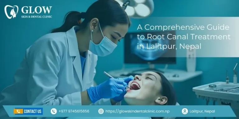 A Comprehensive Guide to Root Canal Treatment in lalitpur, Nepal