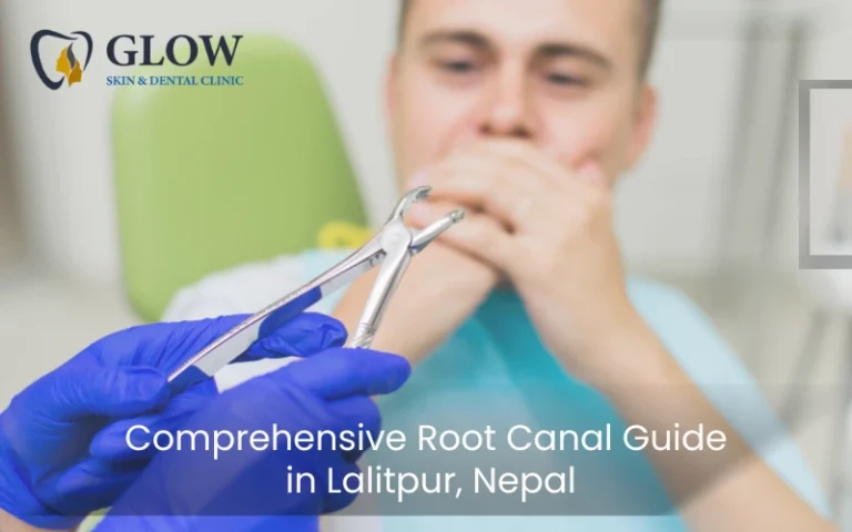 Comprehensive Root Canal Guide in Lalitpur, Nepal….