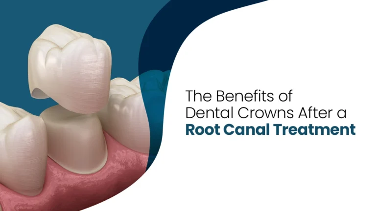 Dentists for Dental Implants and Root Canal Treatments