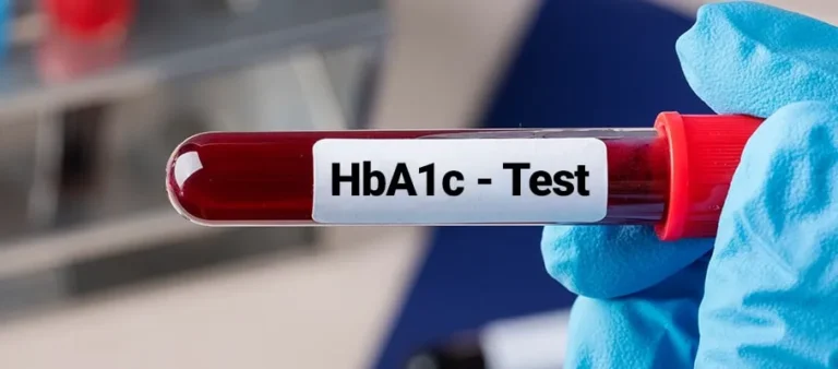 HbA1c Test: A Key Marker for Diabetes Management..