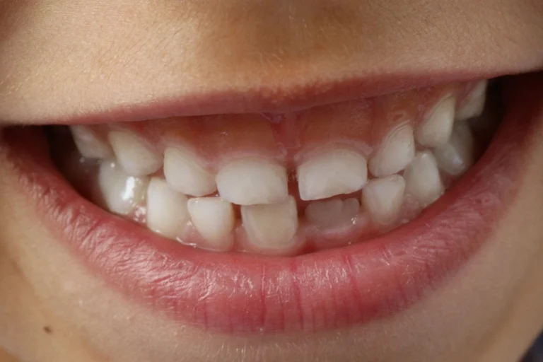 How to Choose the Right Teeth Whitening Service in Elizabethtown, KY